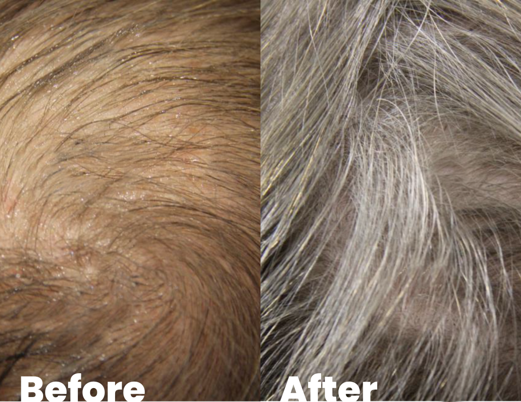 hair treatment before and after