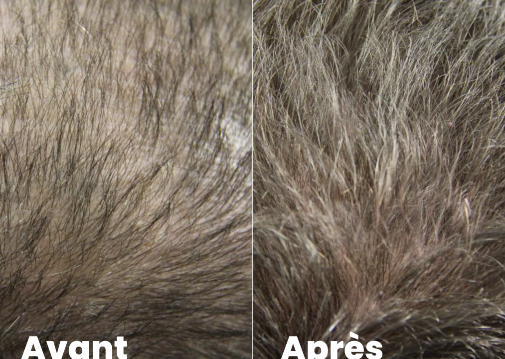 Un homme 6 mois après son traitement des cheveux
